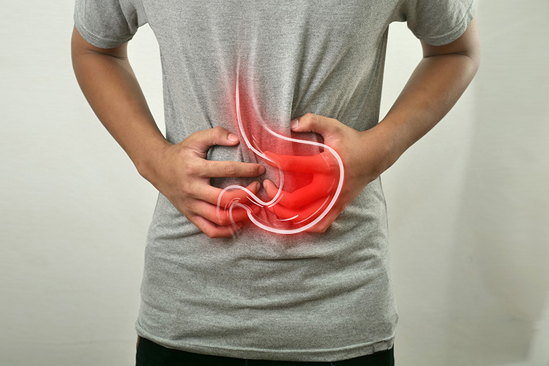 FOTO REFERENCIAL CÁNCER GÁSTRICO